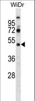 SPT7L / SUPT7L Antibody - SUPT7L Antibody western blot of WiDr cell line lysates (35 ug/lane). The SUPT7L antibody detected the SUPT7L protein (arrow).
