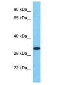 SPT7L / SUPT7L Antibody - SPT7L / SUPT7L antibody Western Blot of HepG2. Antibody dilution: 1 ug/ml.  This image was taken for the unconjugated form of this product. Other forms have not been tested.