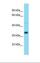 SPT7L / SUPT7L Antibody - Western blot of Mouse Thymus. Supt7l antibody dilution 1.0 ug/ml.  This image was taken for the unconjugated form of this product. Other forms have not been tested.