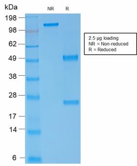 SPTA1 / Alpha Spectrin Antibody - SDS-PAGE Analysis Purified Spectrin alpha 1 Mouse Recombinant Monoclonal (rSPTA1/1833). Confirmation of Purity and Integrity of Antibody.