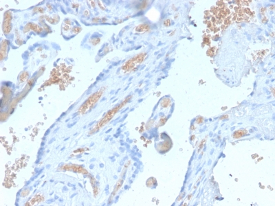 SPTA1 / Alpha Spectrin Antibody - Formalin-fixed, paraffin-embedded human Pancreas stained with Spectrin alpha 1 Rabbit Recombinant Monoclonal Antibody (SPTA1/2939R).