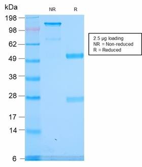 SPTA1 / Alpha Spectrin Antibody - SDS-PAGE Analysis Purified Spectrin alpha 1 Rabbit Recombinant Monoclonal (SPTA1/2939R). Confirmation of Purity and Integrity of Antibody.