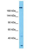 SPTA1 / Alpha Spectrin Antibody - SPTA1 / Alpha Spectrin antibody Western Blot of Fetal Liver. Antibody dilution: 1 ug/ml.  This image was taken for the unconjugated form of this product. Other forms have not been tested.