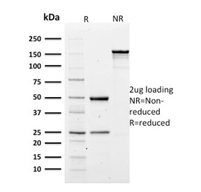SPTA1 / Alpha Spectrin Antibody - SDS-PAGE analysis of purified, BSA-free SPTA1 antibody (clone SPTA1/1810) as confirmation of integrity and purity.