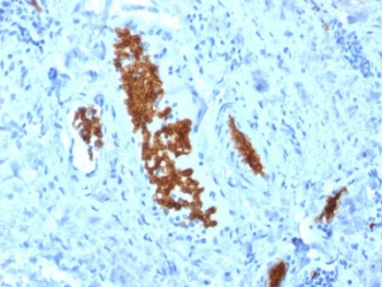 SPTA1 / Alpha Spectrin Antibody - IHC staining of FFPE human tonsil with SPTA1 antibody (clone SPTA1/1810). Required HIER: boil tissue sections in pH6, 10mM citrate buffer, for 10-20 min followed by cooling at RT for 20 min.