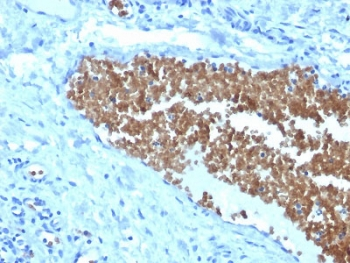 SPTA1 / Alpha Spectrin Antibody - IHC staining of FFPE human tonsil with Spectrin alpha 1 antibody (clone SPTA1/1832). Required HIER: boil tissue sections in pH6, 10mM citrate buffer, for 10-20 min followed by cooling at RT for 20 min.