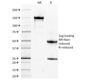SPTA1 / Alpha Spectrin Antibody - SDS-PAGE analysis of purified, BSA-free Spectrin alpha 1 antibody (clone SPTA1/1832) as confirmation of integrity and purity.