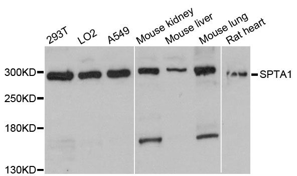 SPTA1 / Alpha Spectrin Antibody - Western blot analysis of extracts of various cell lines, using SPTA1 antibody at 1:3000 dilution. The secondary antibody used was an HRP Goat Anti-Rabbit IgG (H+L) at 1:10000 dilution. Lysates were loaded 25ug per lane and 3% nonfat dry milk in TBST was used for blocking. An ECL Kit was used for detection and the exposure time was 10s.