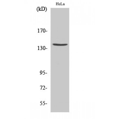SPTAN1 / Alpha Fodrin Antibody - Western blot of Cleaved-Spectrin alpha II (D1185) antibody