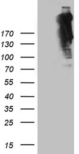 SPTAN1 / Alpha Fodrin Antibody - HEK293T cells were transfected with the pCMV6-ENTRY control. (Left lane) or pCMV6-ENTRY SPTAN1. (Right lane) cDNA for 48 hrs and lysed. Equivalent amounts of cell lysates. (5 ug per lane) were separated by SDS-PAGE and immunoblotted with anti-SPTAN1. (1:2000)