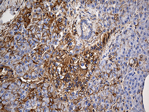 SPTAN1 / Alpha Fodrin Antibody - Immunohistochemical staining of paraffin-embedded Human pancreas tissue within the normal limits using anti-SPTAN1 mouse monoclonal antibody. (Heat-induced epitope retrieval by 1mM EDTA in 10mM Tris buffer. (pH8.5) at 120°C for 3 min. (1:2000)