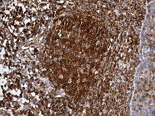 SPTAN1 / Alpha Fodrin Antibody - Immunohistochemical staining of paraffin-embedded Human tonsil within the normal limits using anti-SPTAN1 mouse monoclonal antibody. (Heat-induced epitope retrieval by 1mM EDTA in 10mM Tris buffer. (pH8.5) at 120°C for 3 min. (1:2000)