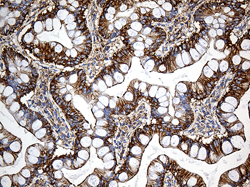 SPTAN1 / Alpha Fodrin Antibody - Immunohistochemical staining of paraffin-embedded Human colon tissue within the normal limits using anti-SPTAN1 mouse monoclonal antibody. (Heat-induced epitope retrieval by 1mM EDTA in 10mM Tris buffer. (pH8.5) at 120°C for 3 min. (1:2000)