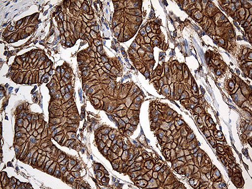SPTAN1 / Alpha Fodrin Antibody - Immunohistochemical staining of paraffin-embedded Human gastric tissue within the normal limits using anti-SPTAN1 mouse monoclonal antibody. (Heat-induced epitope retrieval by 1mM EDTA in 10mM Tris buffer. (pH8.5) at 120°C for 3 min. (1:2000)