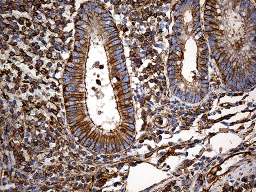 SPTAN1 / Alpha Fodrin Antibody - Immunohistochemical staining of paraffin-embedded Human appendix tissue within the normal limits using anti-SPTAN1 mouse monoclonal antibody. (Heat-induced epitope retrieval by 1mM EDTA in 10mM Tris buffer. (pH8.5) at 120°C for 3 min. (1:2000)