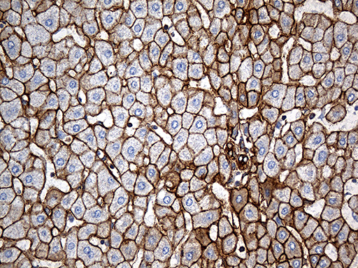 SPTAN1 / Alpha Fodrin Antibody - Immunohistochemical staining of paraffin-embedded Human liver tissue within the normal limits using anti-SPTAN1 mouse monoclonal antibody. (Heat-induced epitope retrieval by 1mM EDTA in 10mM Tris buffer. (pH8.5) at 120°C for 3 min. (1:2000)