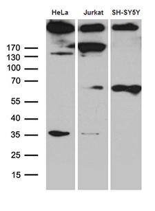 SPTAN1 / Alpha Fodrin Antibody - Western blot analysis of extracts. (35ug) from 3 cell line by using anti-SPTAN1 monoclonal antibody. (1:500)
