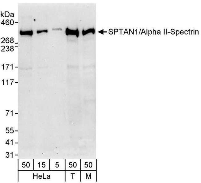 SPTAN1 / Alpha Fodrin Antibody - Detection of Human and Mouse SPTAN1/Alpha II-Spectrin by Western Blot. Samples: Whole cell lysate from HeLa (5, 15 and 50 ug), 293T (T; 50 ug), and mouse NIH3T3 (M; 50 ug) cells. Antibody: Affinity purified rabbit anti-SPTAN1/Alpha II-Spectrin antibody used for WB at 0.2 ug/ml. Detection: Chemiluminescence with an exposure time of 30 seconds.