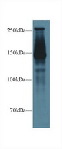 SPTAN1 / Alpha Fodrin Antibody - Western Blot; Sample: Rat Lung lysate; Primary Ab: 1µg/ml Rabbit Anti-Rat SPTAN1 Antibody Second Ab: 0.2µg/mL HRP-Linked Caprine Anti-Rabbit IgG Polyclonal Antibody
