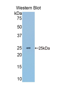 SPTAN1 / Alpha Fodrin Antibody - Western blot of recombinant SPTAN1 / Alpha Fodrin.  This image was taken for the unconjugated form of this product. Other forms have not been tested.