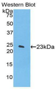 SPTAN1 / Alpha Fodrin Antibody - Western blot of recombinant SPTAN1 / Alpha Fodrin.  This image was taken for the unconjugated form of this product. Other forms have not been tested.