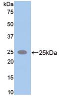 SPTAN1 / Alpha Fodrin Antibody - Western Blot; Sample: Recombinant SPTAN1, Rat.