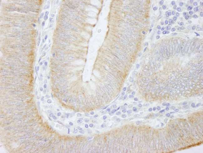 SPTAN1 / Alpha Fodrin Antibody - Detection of Human SPTAN1/Alpha II-spectrin by Immunohistochemistry. Sample: FFPE section of human colon carcinoma. Antibody: Affinity purified rabbit anti-SPTAN1/Alpha II-spectrin used at a dilution of 1:250.