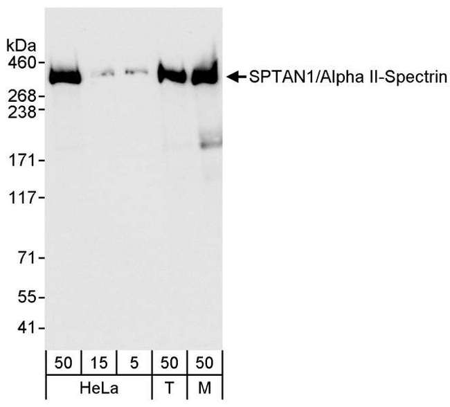 SPTAN1 / Alpha Fodrin Antibody - Detection of Human and Mouse SPTAN1/Alpha II-Spectrin by Western Blot. Samples: Whole cell lysate from HeLa (5, 15 and 50 ug), 293T (T; 50 ug), and mouse NIH3T3 (M; 50 ug) cells. Antibody: Affinity purified rabbit anti-SPTAN1/Alpha II-Spectrin antibody used for WB at 0.04 ug/ml Detection: Chemiluminescence with an exposure time of 3 seconds.