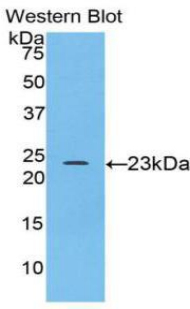 SPTAN1 / Alpha Fodrin Antibody - Western blot of recombinant SPTAN1 / Alpha Fodrin.  This image was taken for the unconjugated form of this product. Other forms have not been tested.