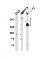 SPTAN1 / Alpha Fodrin Antibody - All lanes : Anti-SPTAN1 Antibody at 1:1000 dilution Lane 1: HeLa whole cell lysates Lane 2: NIH/3T3 whole cell lysates Lane 3: rat kidney lysates Lysates/proteins at 20 ug per lane. Secondary Goat Anti-Rabbit IgG, (H+L), Peroxidase conjugated at 1/10000 dilution Predicted band size : 285 kDa Blocking/Dilution buffer: 5% NFDM/TBST.