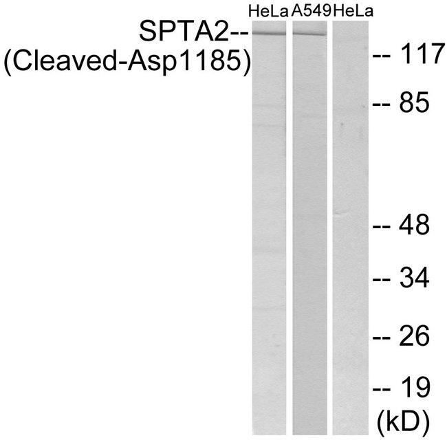 SPTAN1 / Alpha Fodrin Antibody - Western blot analysis of extracts from HeLa cells and A549 cells, all treated with etoposide (25uM, 24hours), using SPTA2 (Cleaved-Asp1185) antibody.