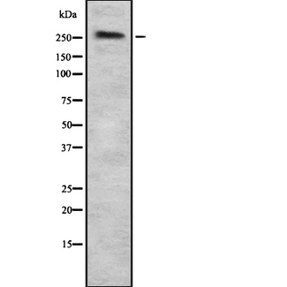 SPTAN1 / Alpha Fodrin Antibody - Western blot analysis of SPTAN1 using HuvEc whole lysates.