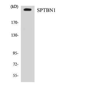 SPTBN1 / ELF Antibody - Western blot analysis of the lysates from Jurkat cells using SPTBN1 antibody.