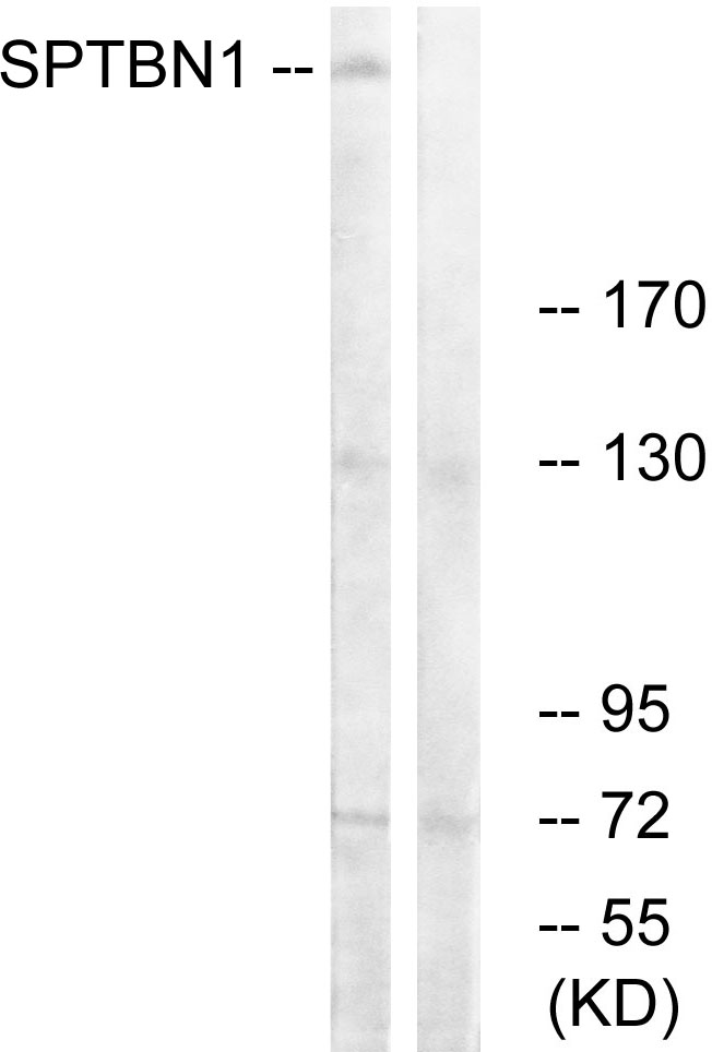 SPTBN1 / ELF Antibody - Western blot analysis of lysates from COLO cells, using SPTBN1 Antibody. The lane on the right is blocked with the synthesized peptide.