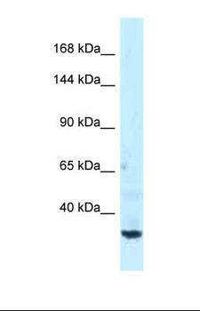 SPTBN1 / ELF Antibody - Western blot of Human NCI-H226. SPTBN1 antibody dilution 1.0 ug/ml.  This image was taken for the unconjugated form of this product. Other forms have not been tested.