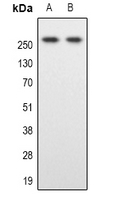 SPTBN1 / ELF Antibody - Western blot analysis of SPTBN1 expression in HeLa (A); Colo205 (B) whole cell lysates.