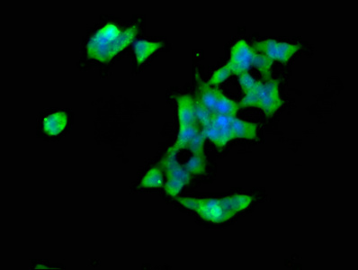 SPTBN1 / ELF Antibody - Immunofluorescence staining of 293 cells at a dilution of 1:66, counter-stained with DAPI. The cells were fixed in 4% formaldehyde, permeabilized using 0.2% Triton X-100 and blocked in 10% normal Goat Serum. The cells were then incubated with the antibody overnight at 4 °C.The secondary antibody was Alexa Fluor 488-congugated AffiniPure Goat Anti-Rabbit IgG (H+L) .