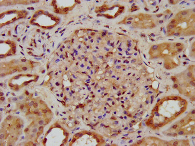 SPTBN1 / ELF Antibody - IHC image of SPTBN1 Antibody diluted at 1:200 and staining in paraffin-embedded human kidney tissue performed on a Leica BondTM system. After dewaxing and hydration, antigen retrieval was mediated by high pressure in a citrate buffer (pH 6.0). Section was blocked with 10% normal goat serum 30min at RT. Then primary antibody (1% BSA) was incubated at 4°C overnight. The primary is detected by a biotinylated secondary antibody and visualized using an HRP conjugated SP system.