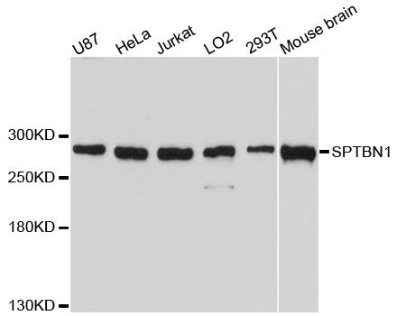 SPTBN1 / ELF Antibody - Western blot analysis of extracts of various cell lines, using SPTBN1 antibody at 1:3000 dilution. The secondary antibody used was an HRP Goat Anti-Rabbit IgG (H+L) at 1:10000 dilution. Lysates were loaded 25ug per lane and 3% nonfat dry milk in TBST was used for blocking. An ECL Kit was used for detection and the exposure time was 10s.