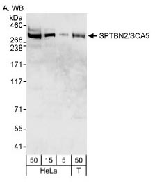 SPTBN2 Antibody - Detection of SPTBN2 in Hela cell extracts.  This image was taken for the unconjugated form of this product. Other forms have not been tested.