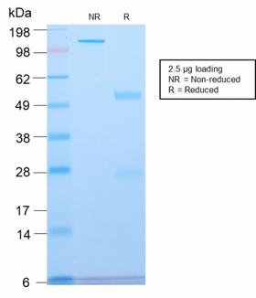 SPTBN2 Antibody - SDS-PAGE Analysis Purified Spectrin beta III Rabbit Recombinant Monoclonal (SPTBN2/2894R). Confirmation of Purity and Integrity of Antibody.