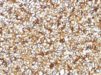 SPTBN2 Antibody - IHC testing of FFPE human pancreas with Spectrin beta III antibody (clone SPTBN2/1582). Required HIER: boil tissue sections in 10mM citrate buffer, pH 6, for 10-20 min followed by cooling at RT for 20 min.