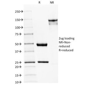 SPTBN2 Antibody - SDS-PAGE Analysis of Purified, BSA-Free Spectrin beta III Antibody (clone SPTBN2/1582). Confirmation of Integrity and Purity of the Antibody.