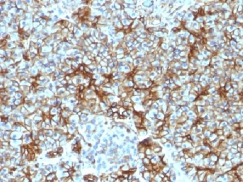 SPTBN2 Antibody - IHC testing of FFPE human pancreas with Spectrin beta III antibody (clone SPTBN2/1583). Required HIER: boil tissue sections in 10mM citrate buffer, pH 6, for 10-20 min followed by cooling at RT for 20 min.
