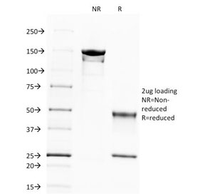 SPTBN2 Antibody - SDS-PAGE Analysis of Purified, BSA-Free Spectrin beta III Antibody (clone SPTBN2/1583). Confirmation of Integrity and Purity of the Antibody.