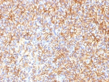 SPTBN2 Antibody - IHC testing of FFPE human pancreas with Spectrin beta III antibody (clone SPTBN2/1584). Required HIER: boil tissue sections in 10mM citrate buffer, pH 6, for 10-20 min followed by cooling at RT for 20 min.