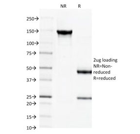 SPTBN2 Antibody - SDS-PAGE Analysis of Purified, BSA-Free Spectrin beta III Antibody (clone SPTBN2/1584). Confirmation of Integrity and Purity of the Antibody.