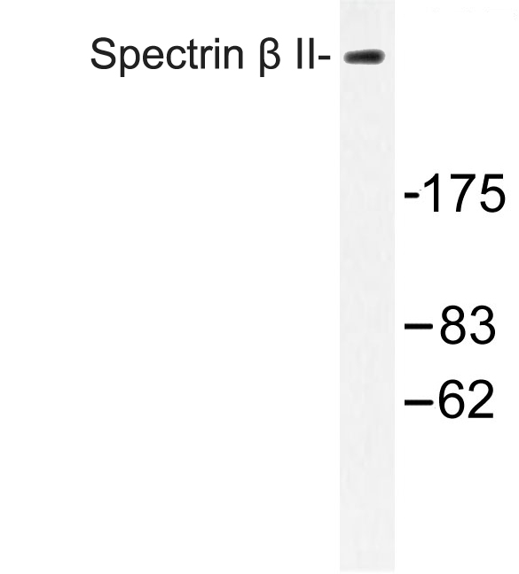 SPTBN2 Antibody - Western blot of Spectrin II (M687) pAb in extracts from COLO cells.