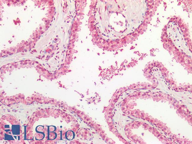 SPTBN4 Antibody - Human Prostate: Formalin-Fixed, Paraffin-Embedded (FFPE)