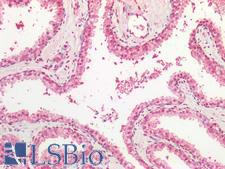 SPTBN4 Antibody - Human Prostate: Formalin-Fixed, Paraffin-Embedded (FFPE)